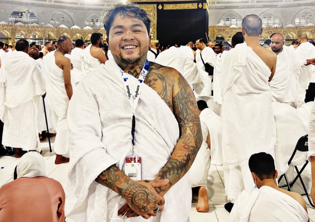 Terlalu Semangat Umroh, King Abdi MasterChef Indonesia Tidak Sadar Jempol Kakinya Patah