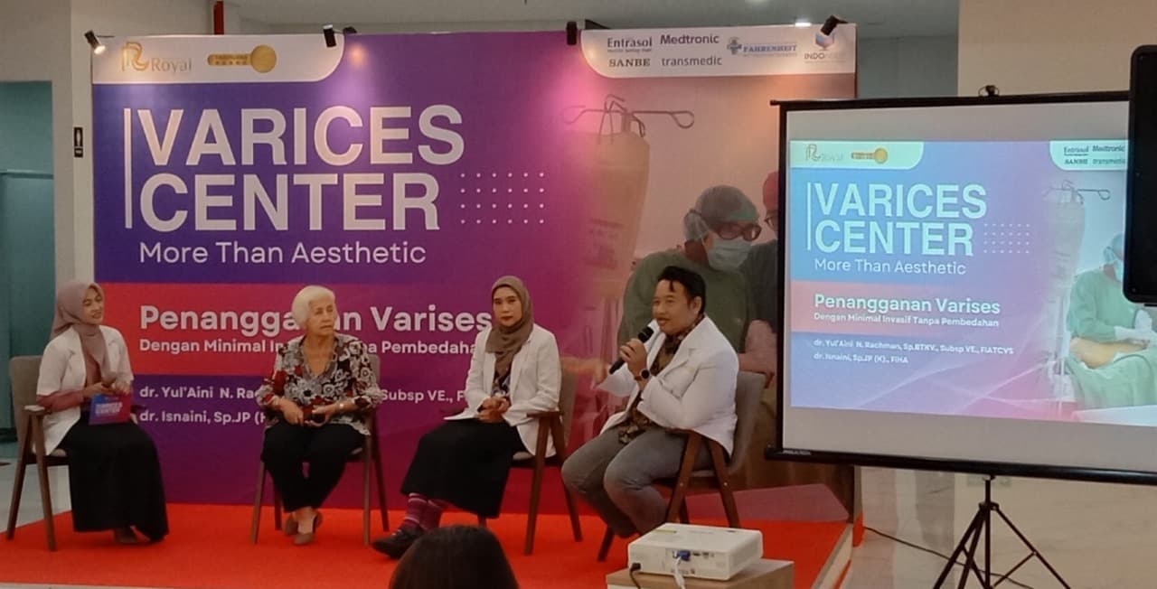 Operasi Varises dengan Laser, Pulih Cepat dan Langsung Bisa Beraktivitas